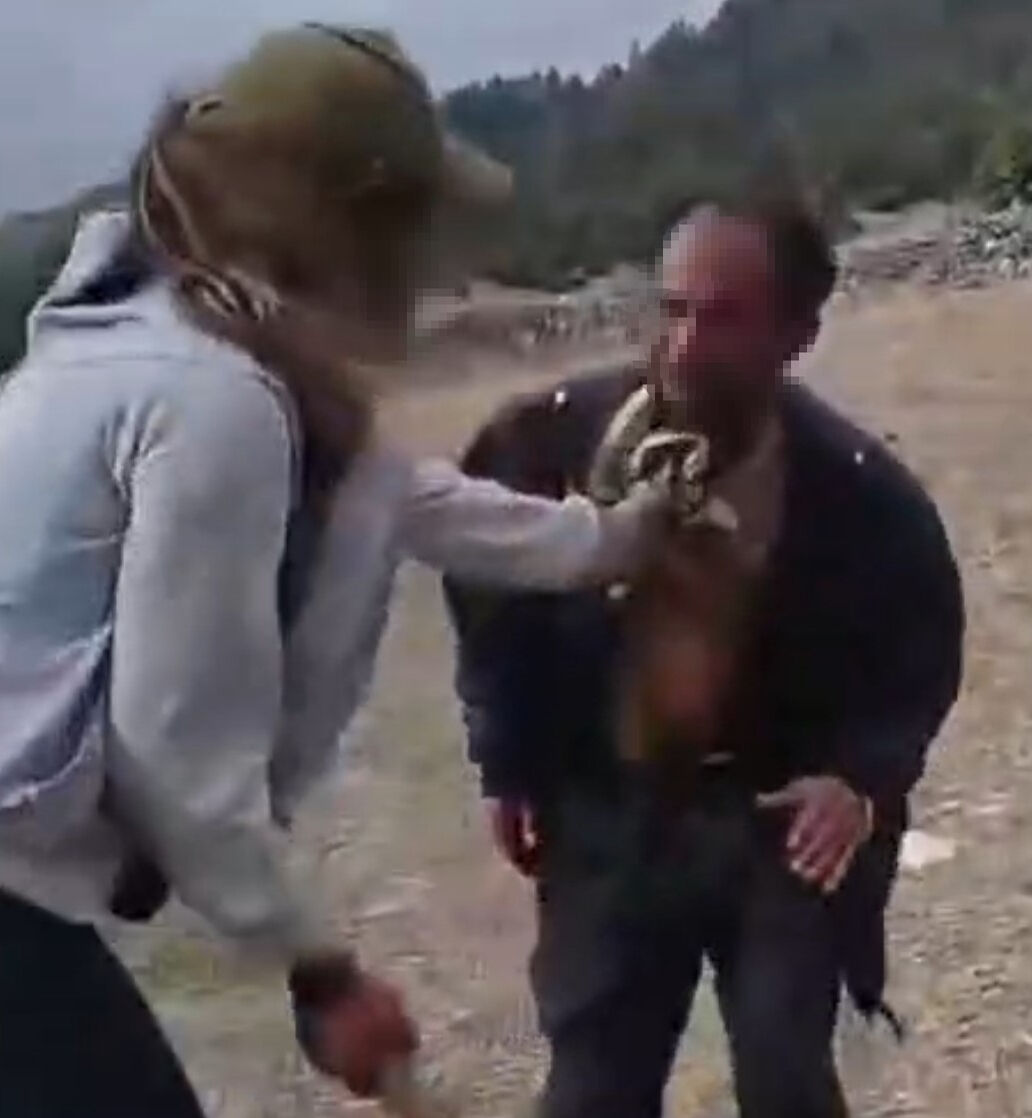 Engelli çobana görülmemiş işkence! Sopayla dövüp halay çektirdiler Engelli çobana görülmemiş işkence! Sopayla dövüp halay çektirdiler - 1. Resim