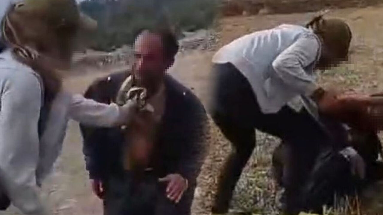 Genç kızlar tarafından öldüresiye darp edilen çoban konuştu: Çok dövdüler, zor kurtuldum - 2. Resim