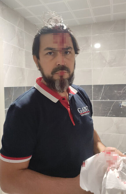 Kastamonu'da veli terörü! Delgeç ile öğretmene saldırdı, başına 5 dikiş atıldı - 1. Resim