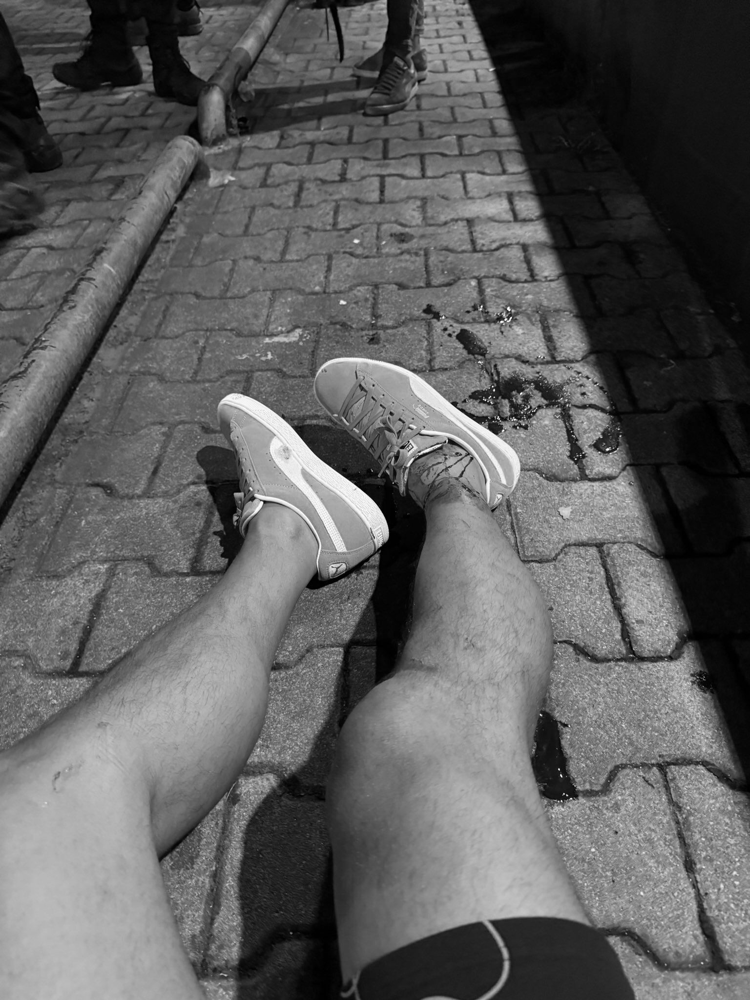 Eski Fenerbahçeli futbolcu Serhat Akın uğradığı silahlı saldırı sonucu ayağından vuruldu Eski Fenerbahçeli futbolcu Serhat Akın uğradığı silahlı saldırı sonucu ayağından vuruldu - 1. Resim