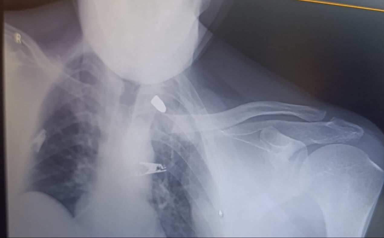 Şanlıurfa'da bir adam uykudan kanlar içerisinde uyandı! Apar topar hastaneye kaldırıldı - 2. Resim