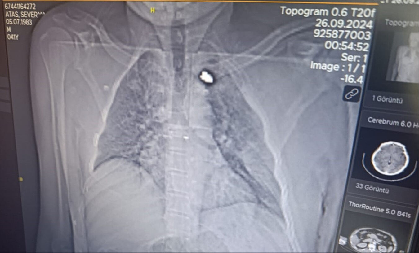 Şanlıurfa'da bir adam uykudan kanlar içerisinde uyandı! Apar topar hastaneye kaldırıldı - 3. Resim