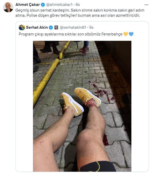 Silahlı saldırıya uğramıştı! Acun Ilıcalı'dan dikkat çeken Serhat Akın mesajı Silahlı saldırıya uğramıştı! Acun Ilıcalı'dan dikkat çeken Serhat Akın mesajı - 2. Resim