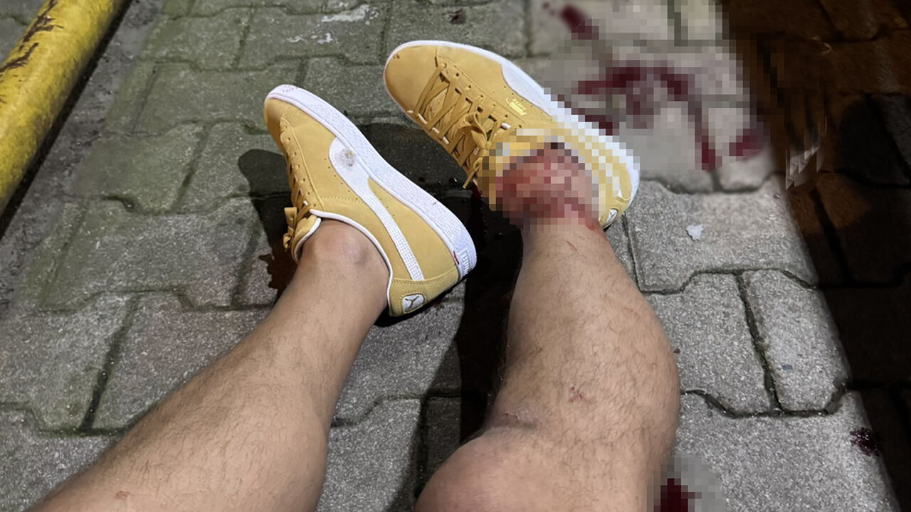 Serhat Akın'ı vuranların kimlikleri belirlendi! 4 şüpheliden 2'si yakalandı Serhat Akın'ı vuranların kimlikleri belirlendi! 4 şüpheliden 2'si yakalandı - 1. Resim