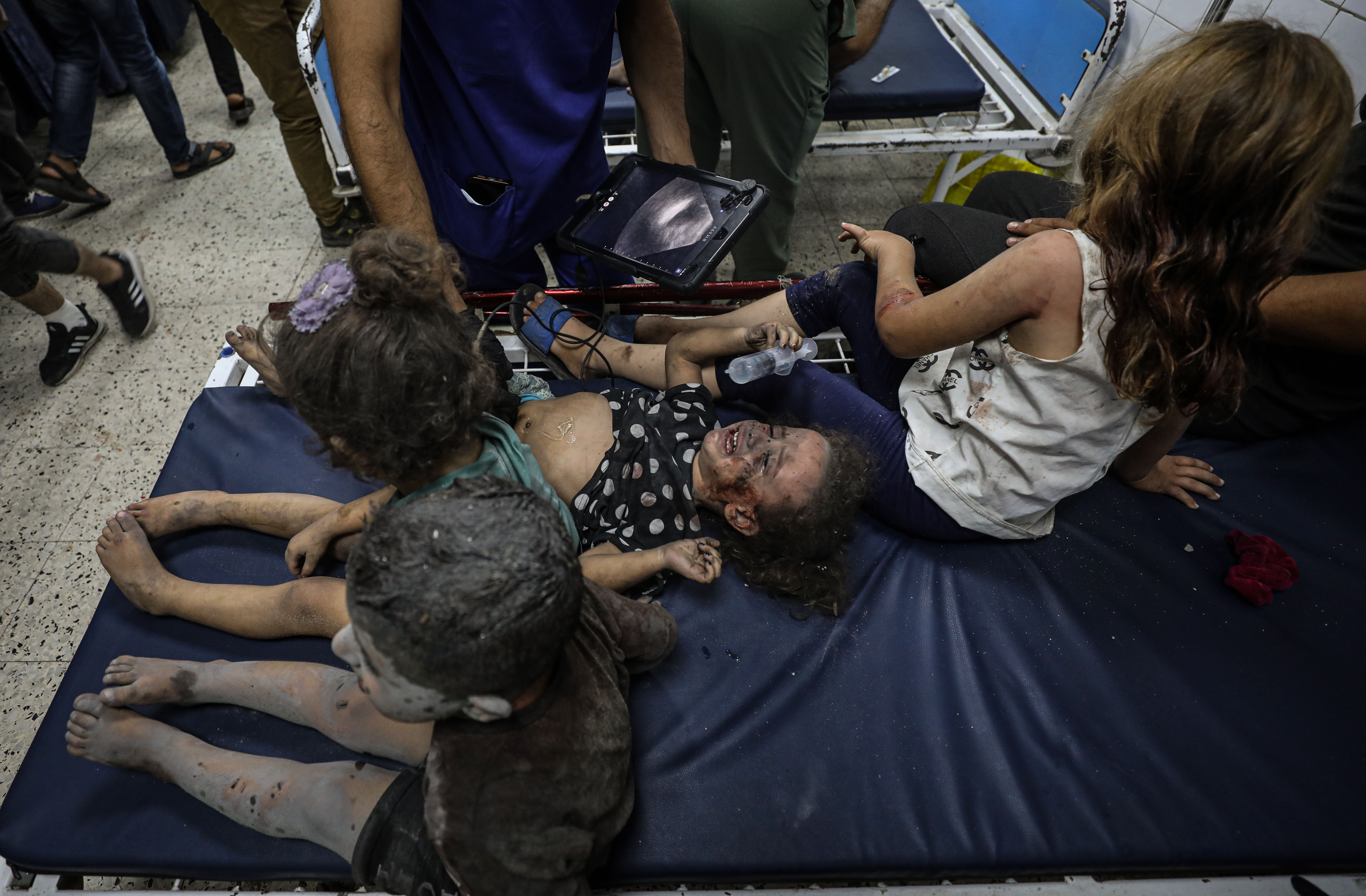İşgal ordusu yine sivilleri hedef aldı! Bombalar bir kez daha çocukların üstüne düştü - 1. Resim