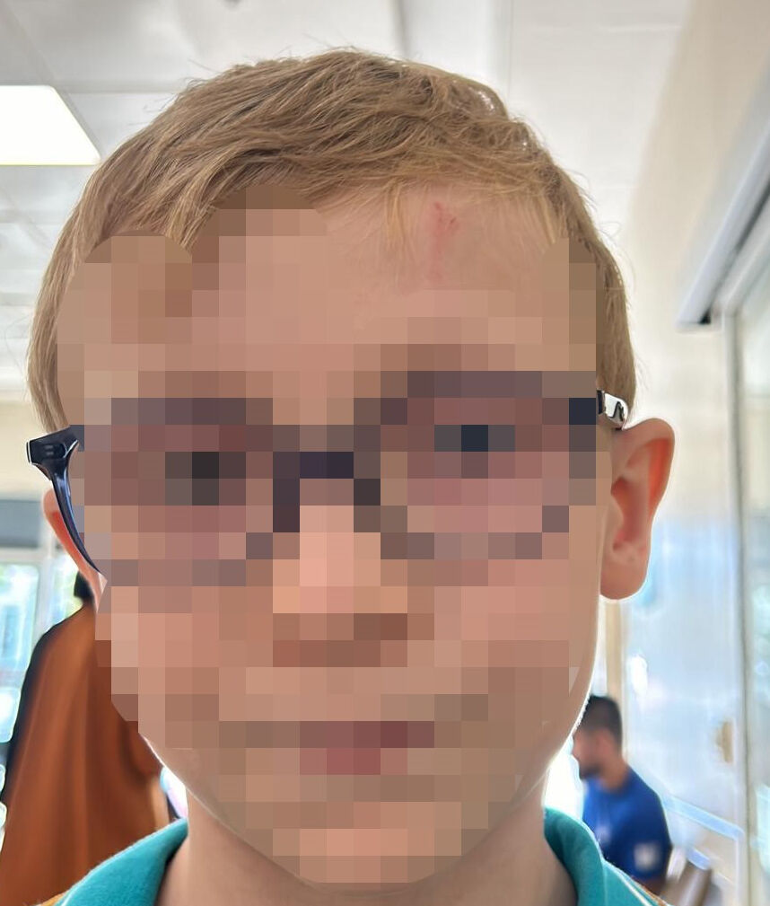 Okulda öğrenciye demir çubukla darp! Öğretmen başka aile başka söylüyor Okulda öğrenciye demir çubukla darp! Öğretmen başka aile başka söylüyor - 2. Resim