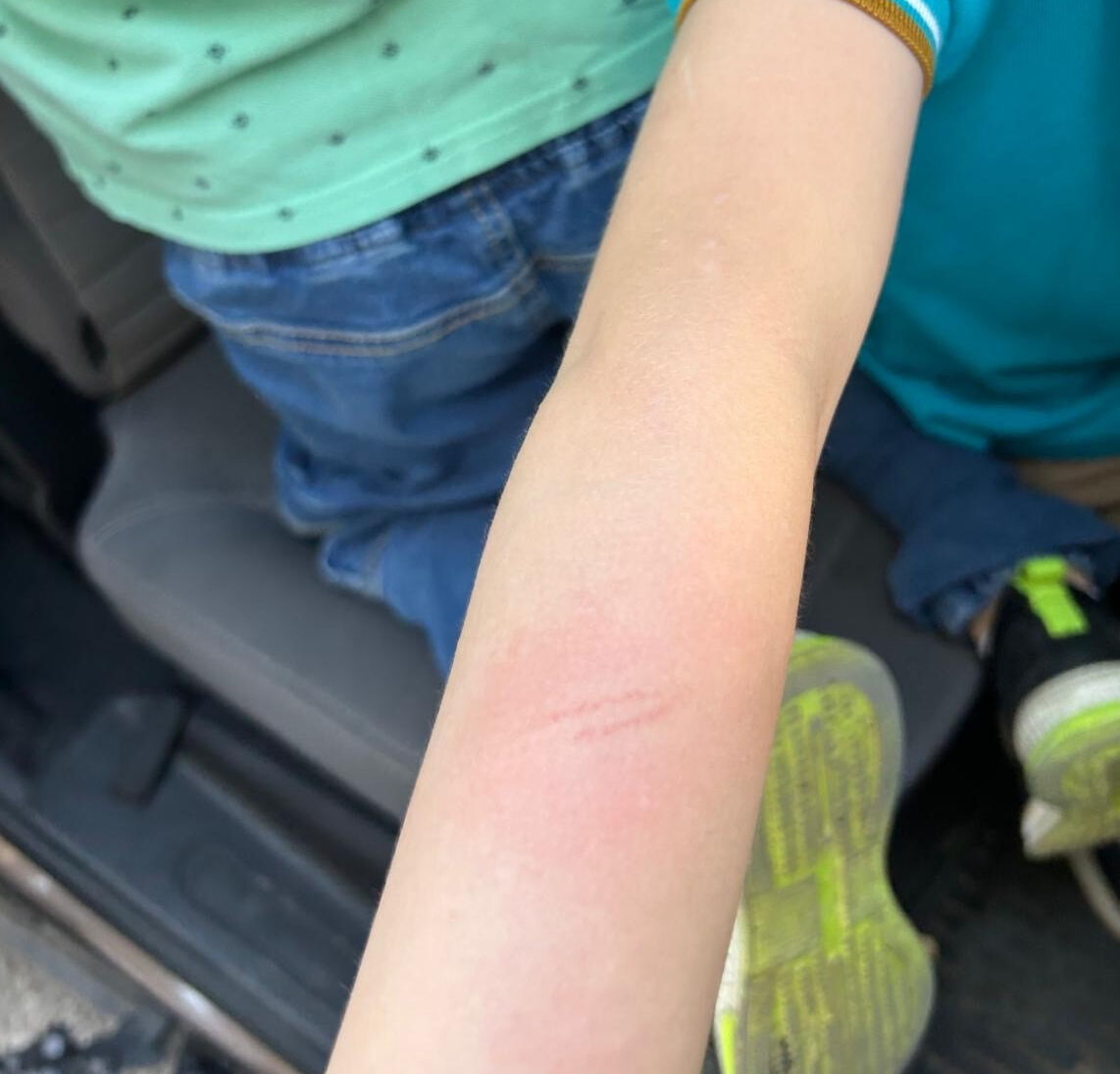 Okulda öğrenciye demir çubukla darp! Öğretmen başka aile başka söylüyor Okulda öğrenciye demir çubukla darp! Öğretmen başka aile başka söylüyor - 3. Resim