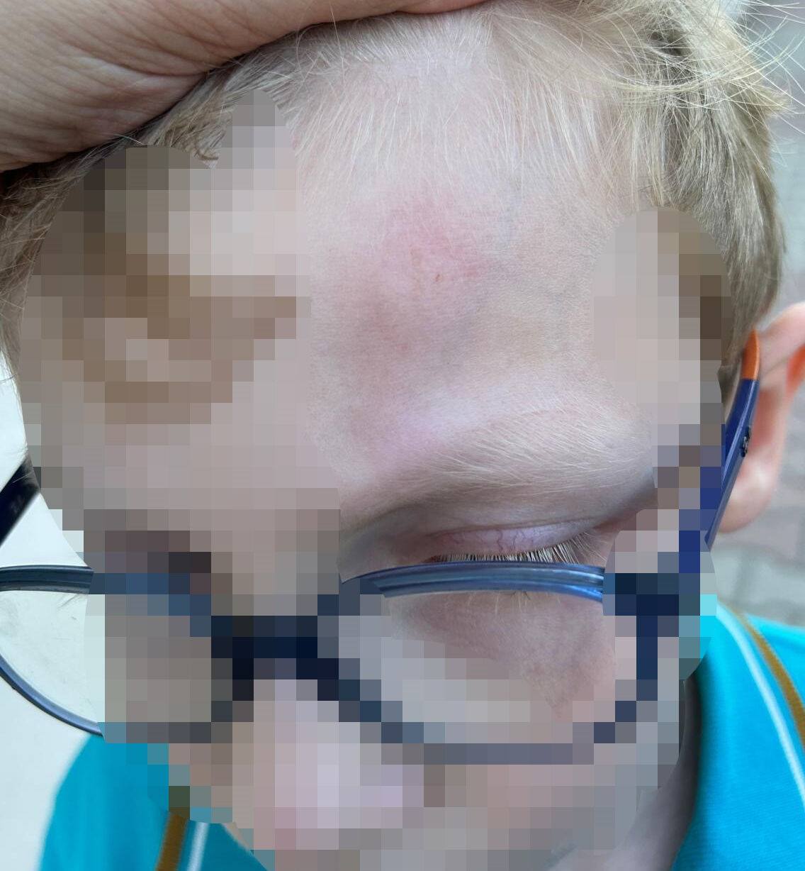 Okulda öğrenciye demir çubukla darp! Öğretmen başka aile başka söylüyor Okulda öğrenciye demir çubukla darp! Öğretmen başka aile başka söylüyor - 1. Resim