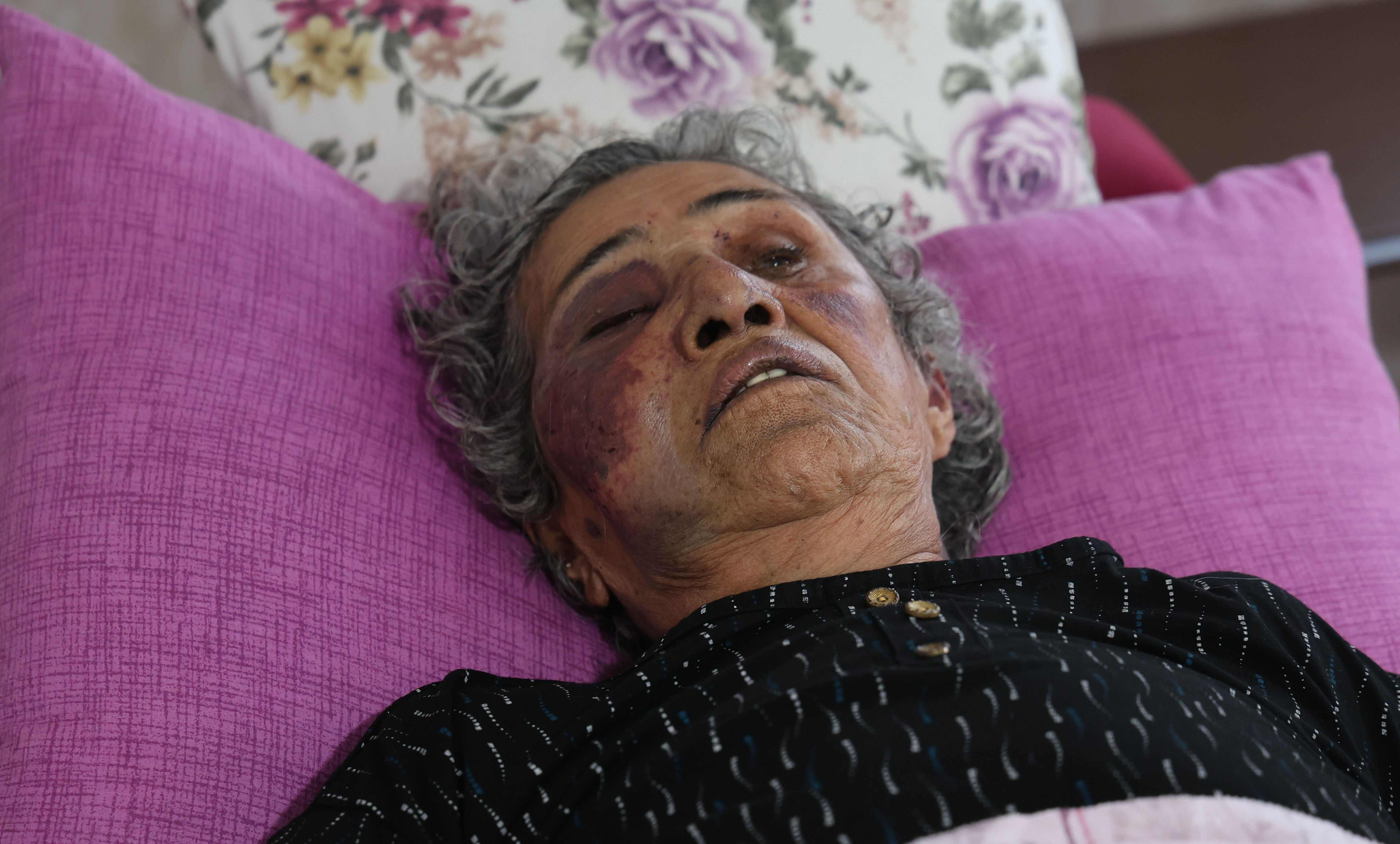 Yaşlı kadını darbedip yüzüğünü çaldı! Mahalleli hortumla dövdü Yaşlı kadını darbedip yüzüğünü çaldı! Mahalleli hortumla dövdü - 2. Resim