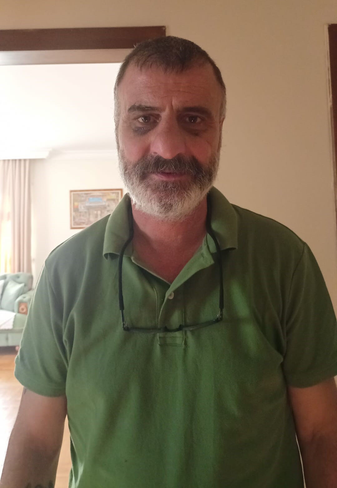 Ankara'da tekel bayine saldırı! Kurala uyan iş yeri sahibinin burnu kırıldı - 1. Resim