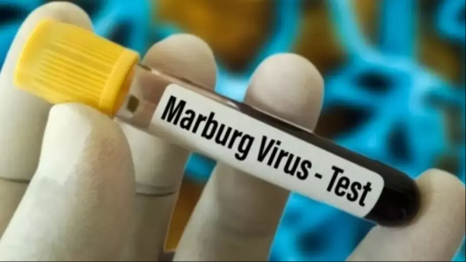 Marburg virüsü belirtileri arasında baş ağrısı, ani kilo kaybı ve ateşlenme yer alıyor - 2. Resim