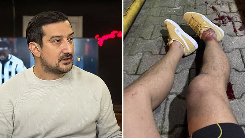 Ayaklarından vurulan Fenerbahçe'nin eski yıldızı Serhat Akın'dan beklenmedik karar! - 4. Resim