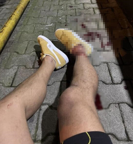 Ayaklarından vurulan Fenerbahçe'nin eski yıldızı Serhat Akın'dan beklenmedik karar! - 6. Resim