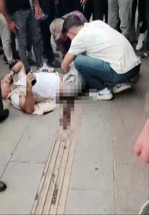 Sokak ortasında sinsi saldırı! Arkadan yaklaşıp bacağından vurdu - 3. Resim