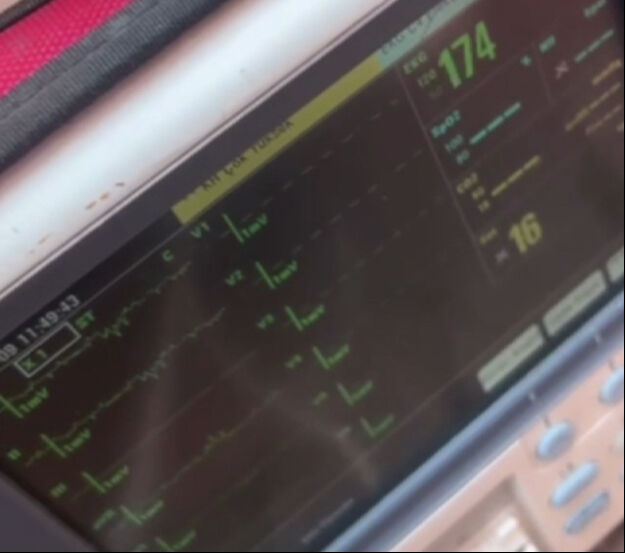 Tabuttan ses gelince yaşadığı anlaşılmıştı! Halit Bayşu'nun nabzının attığı görüntüler ortaya çıktı - 3. Resim