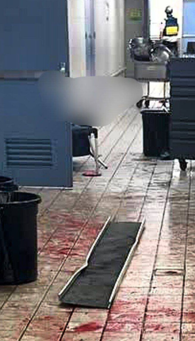 Hizbullah İsrail'de askeri üssü vurdu! Çok sayıda yaralı var - 3. Resim