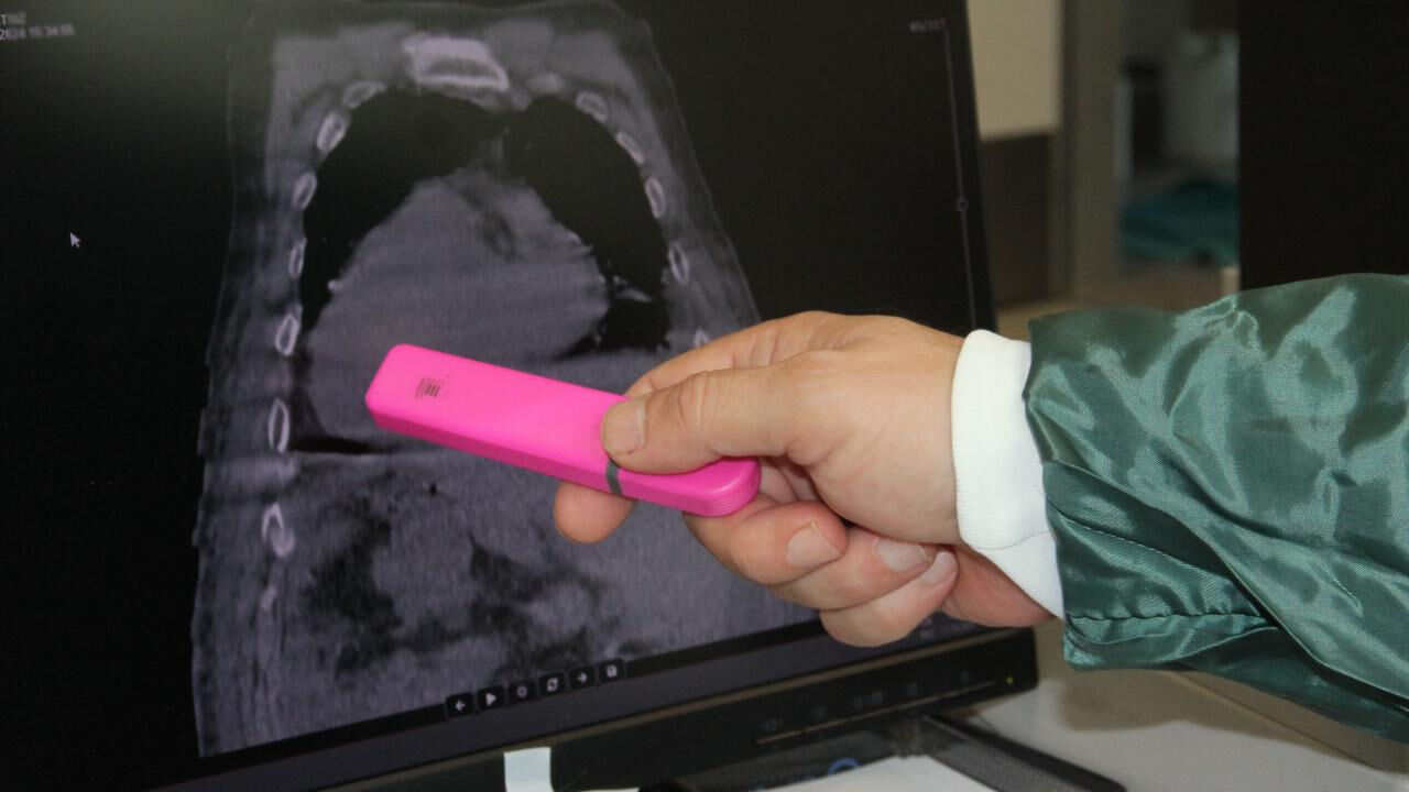 Giresun Sendromu'nu tıp literatürüne kazandıran Prof. Dr. Ahmet Cumhur Dülger oldu - 2. Resim