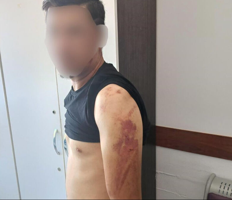 Jandarma, sahte ilanla 20 milyon lira vurgun yapan çeteyi çökertti! İşkencenin kanıtları ortaya çıktı - 3. Resim