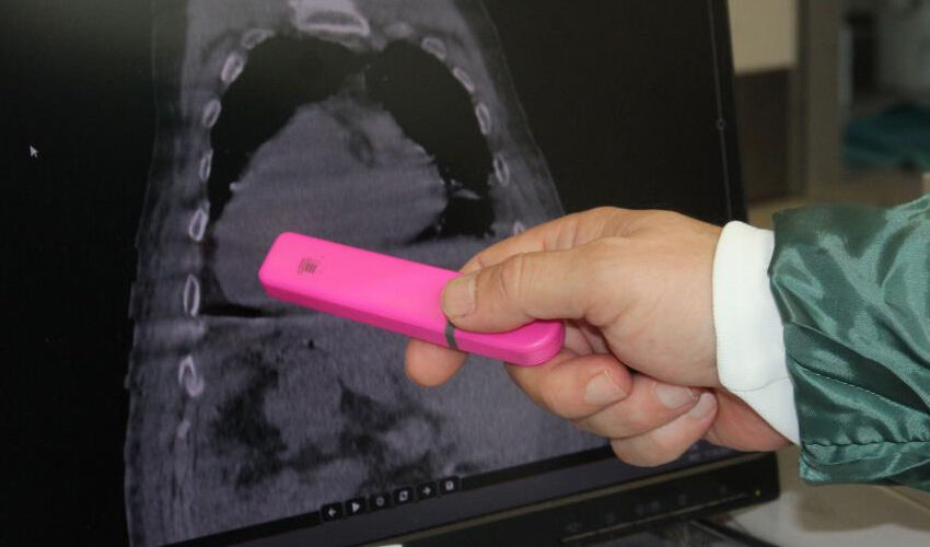 Türkiye ve dünyada bir ilk! ‘Giresun Sendromu’ literatüre geçti... Tüm organları ters dönmüş - 3. Resim