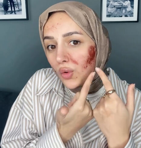 ‘Amin’ videosuyla tanınan Gizem Yıldız tanınmaz halde! Başına gelenleri tek tek anlattı ‘Amin’ videosuyla tanınan Gizem Yıldız tanınmaz halde! Başına gelenleri tek tek anlattı - 2. Resim