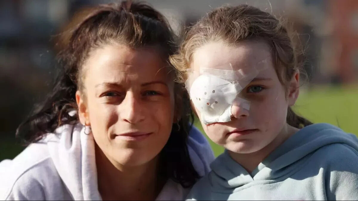 Elektronik sigaranın yüzünde patlaması sonucu bir çocuk gözünü kaybetti - 1. Resim