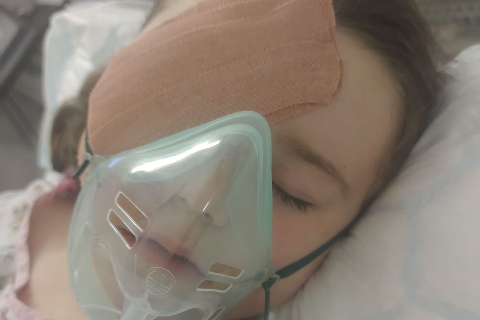 Elektronik sigaranın yüzünde patlaması sonucu bir çocuk gözünü kaybetti - 2. Resim