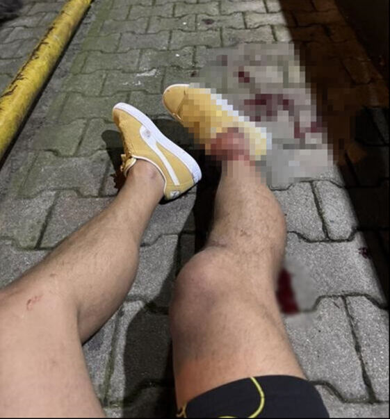 Serhat Akın'a silahlı saldırı düzenleyen 7 kişi için istenen cezalar belli oldu - 4. Resim