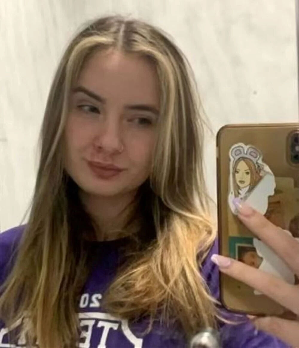 Otobüste korkunç saldırı! Genç kızın yüzünü ısırdı, 50 dikiş atıldı 19 yaşındaki genç kız otobüste saldırıya uğradı, ''Çığlık bile atamadım'' - 2. Resim