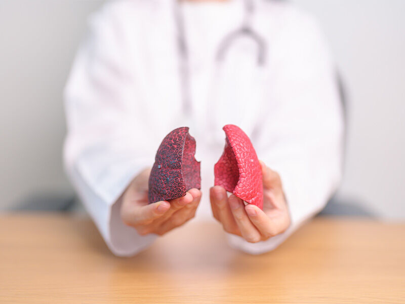 Akciğer kanseri belirtileri, erken teşhis hayat kurtarır ... - 2. Resim