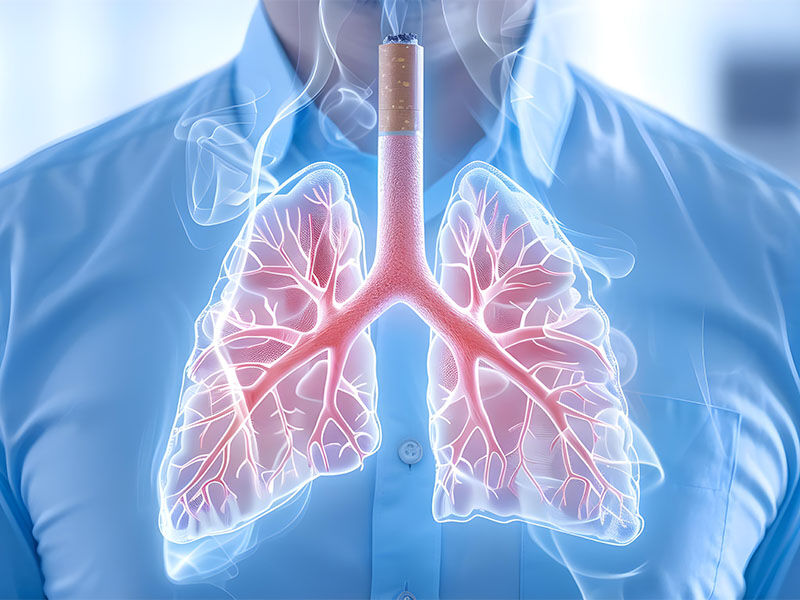Akciğer kanseri belirtileri, erken teşhis hayat kurtarır ... - 3. Resim