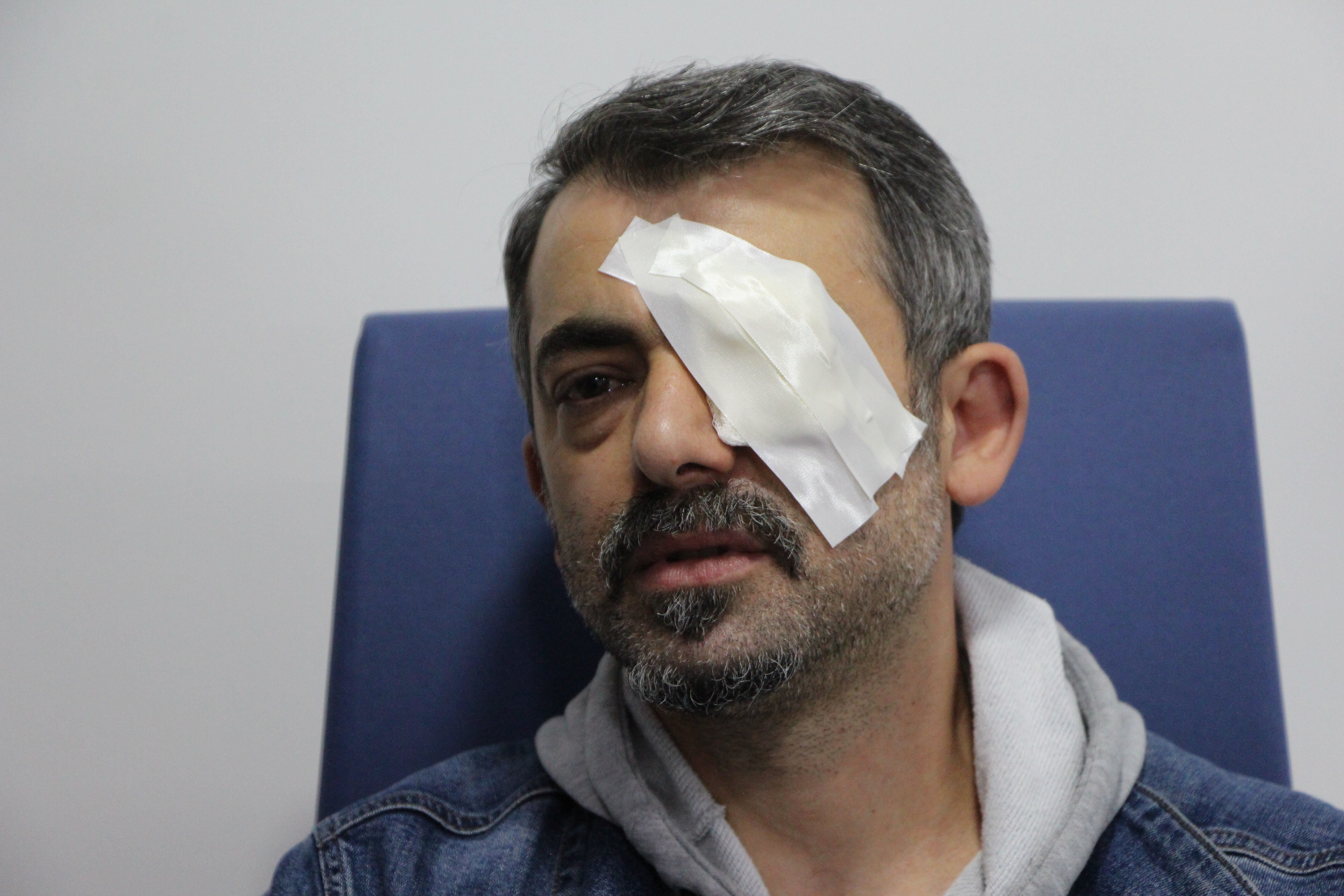 Eşya tamiri yaparken gözüne japon yapıştırıcısı kaçtı! Hastanelik oldu - 1. Resim