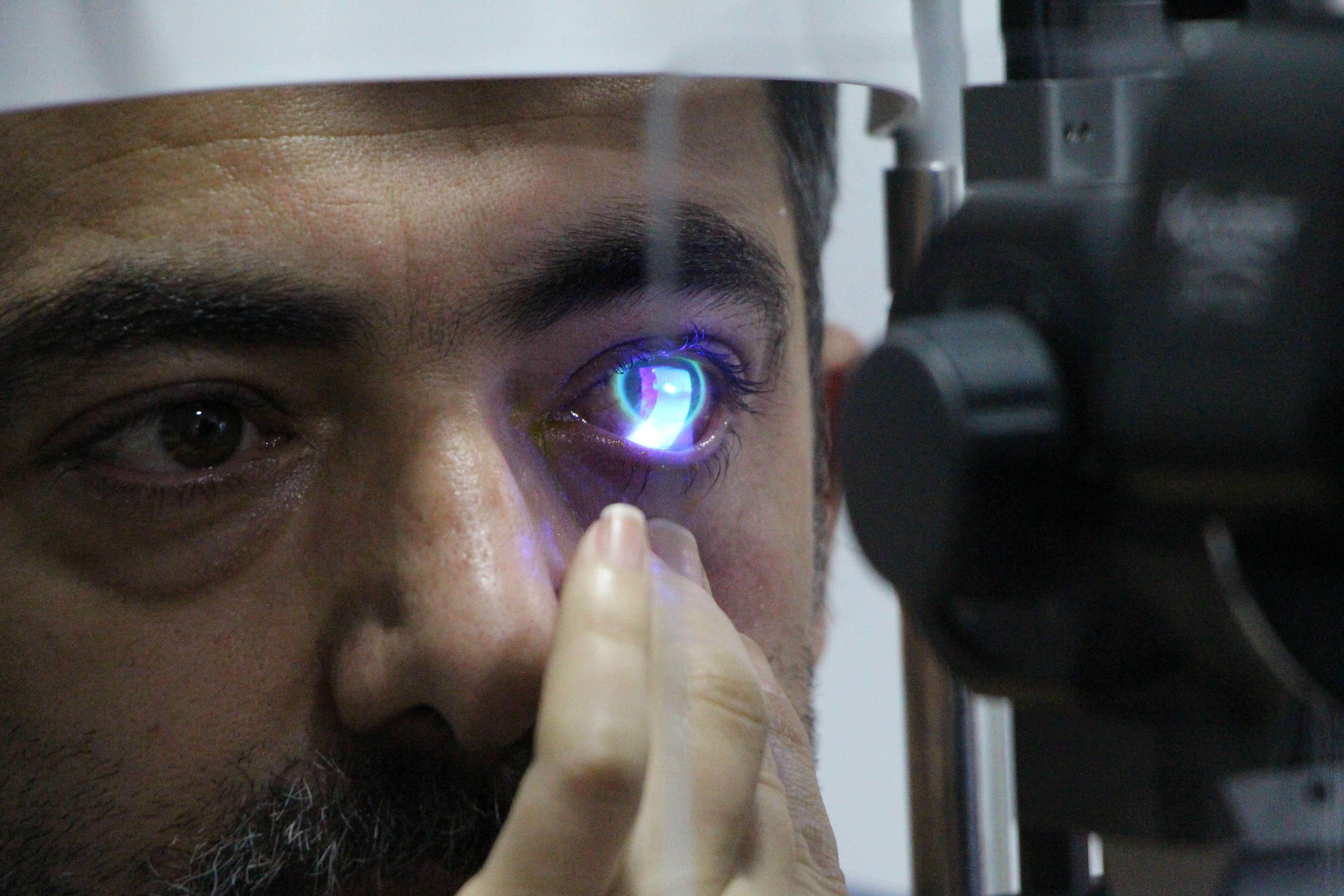 Eşya tamiri yaparken gözüne japon yapıştırıcısı kaçtı! Hastanelik oldu - 4. Resim