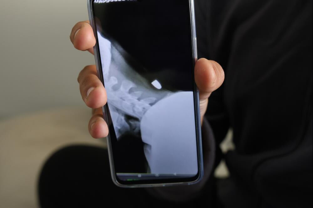 Tek hayali asker olmaktı, başına gelenle şoke oldu! 'Şuan morgda olacaktım...' - 4. Resim