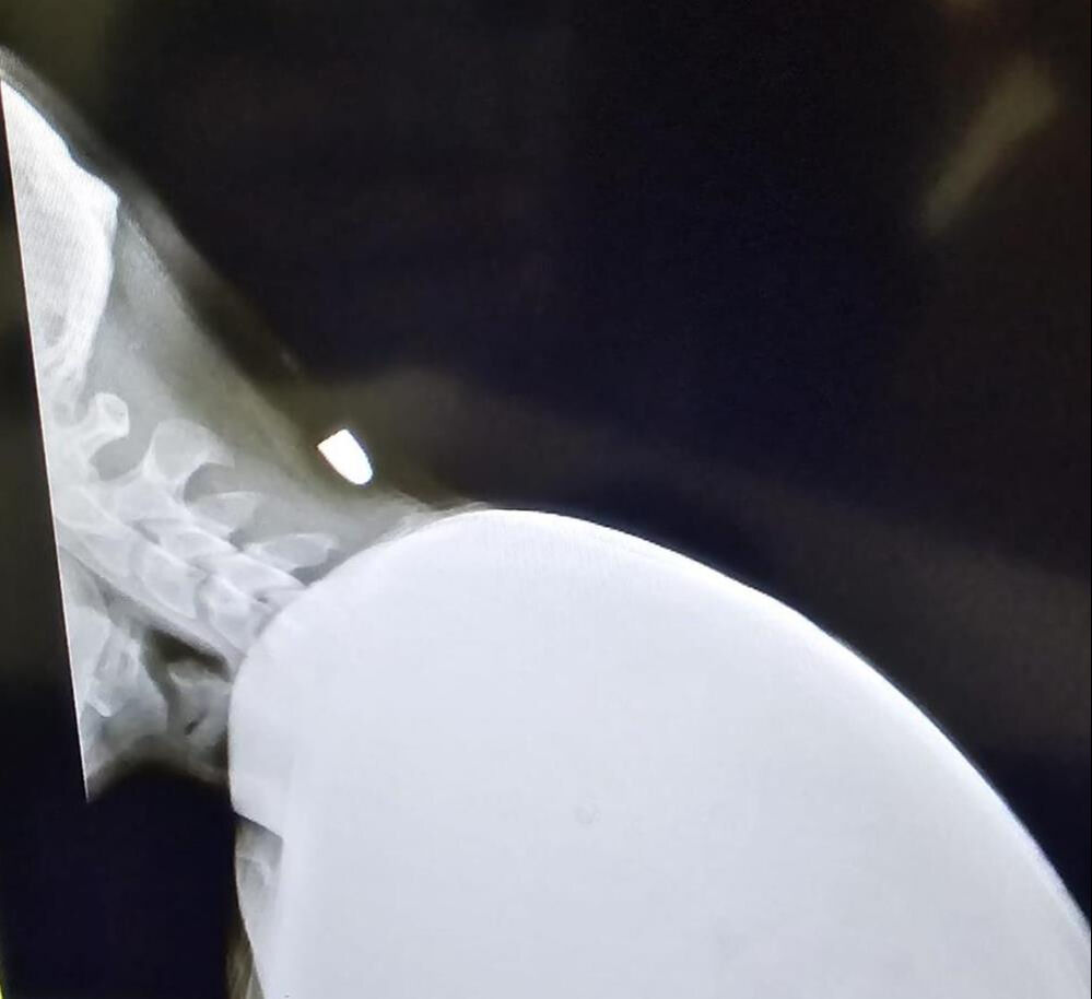 Tek hayali asker olmaktı, başına gelenle şoke oldu! 'Şuan morgda olacaktım...' - 2. Resim