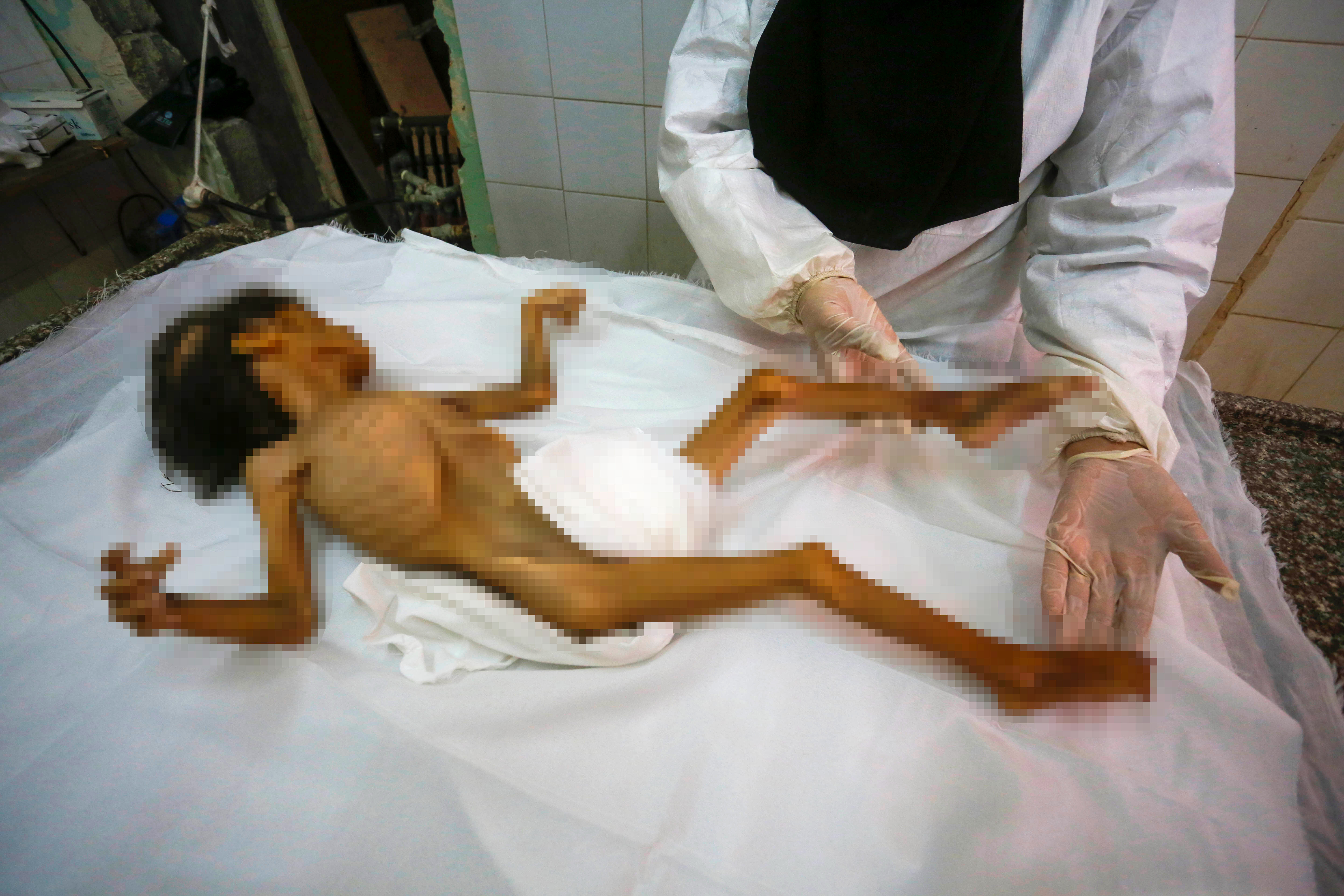 Gazze'de soykırım! Bir çocuk daha açlıktan hayatını kaybetti - 1. Resim