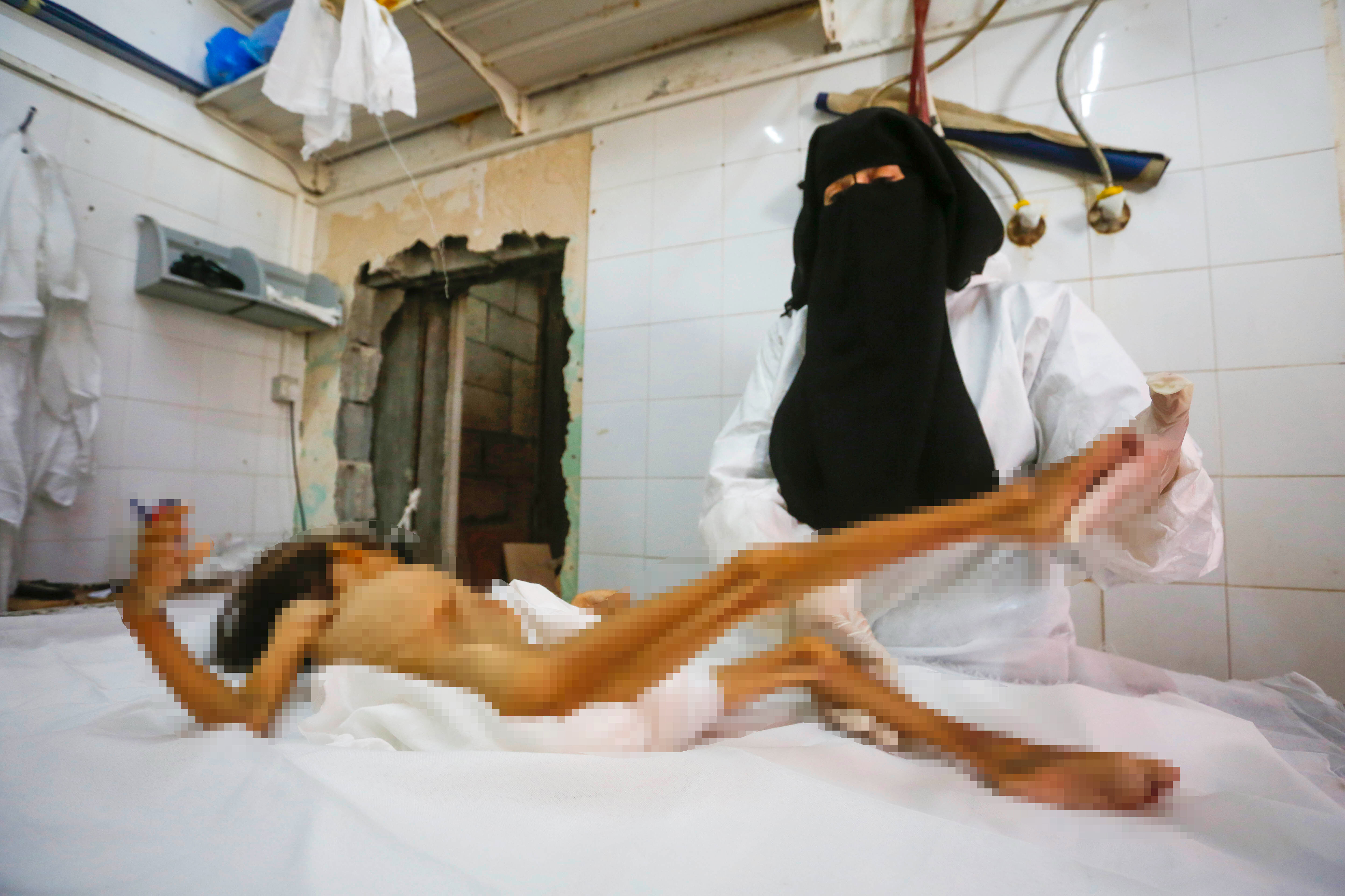 Gazze'de soykırım! Bir çocuk daha açlıktan hayatını kaybetti - 2. Resim