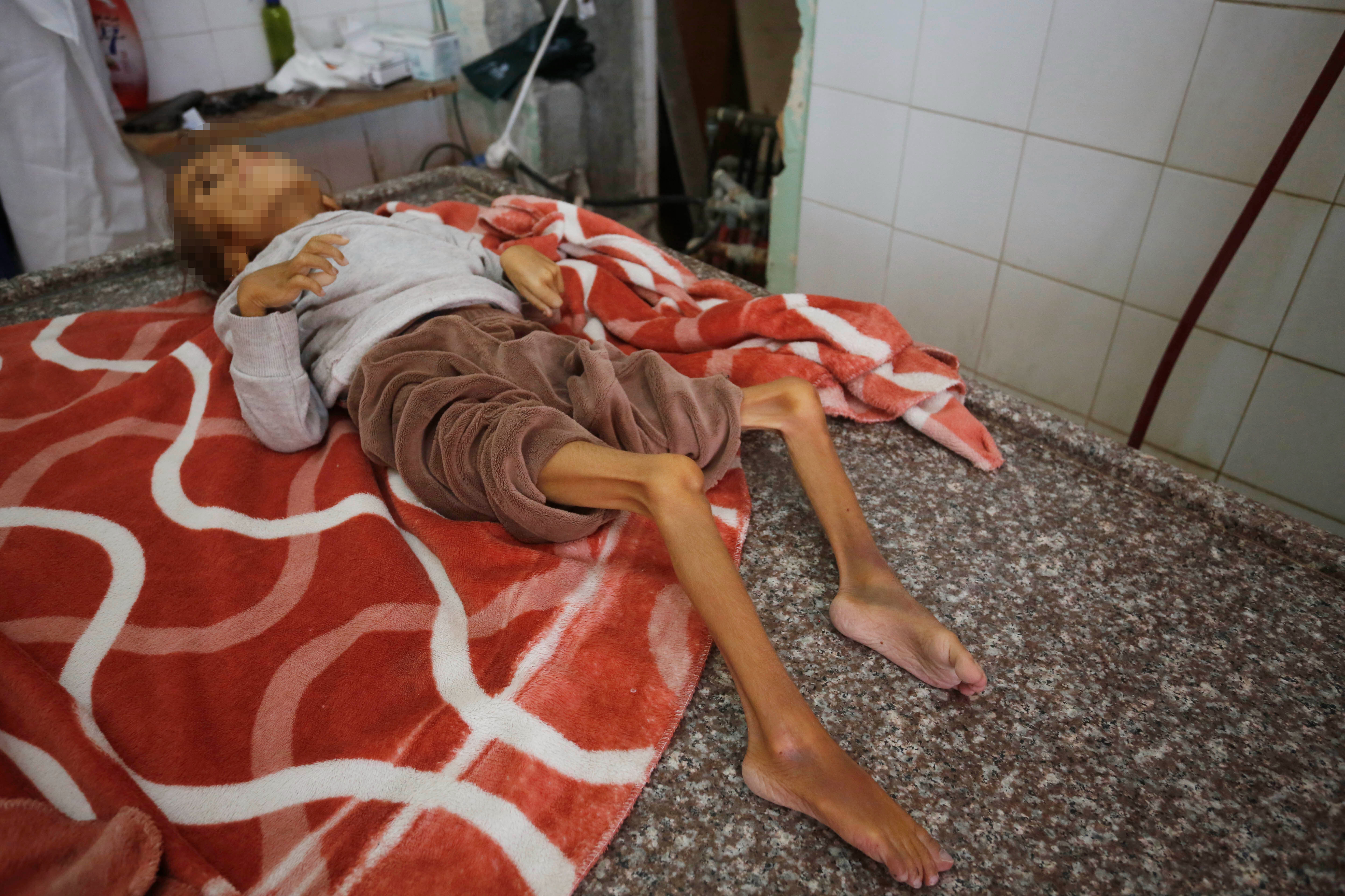 Gazze'de soykırım! Bir çocuk daha açlıktan hayatını kaybetti - 3. Resim