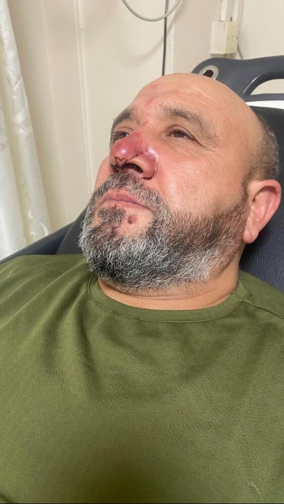 Antalya'da bir grup cami imamına saldırdı! Kızı dakikalarca yalvardı... - 4. Resim