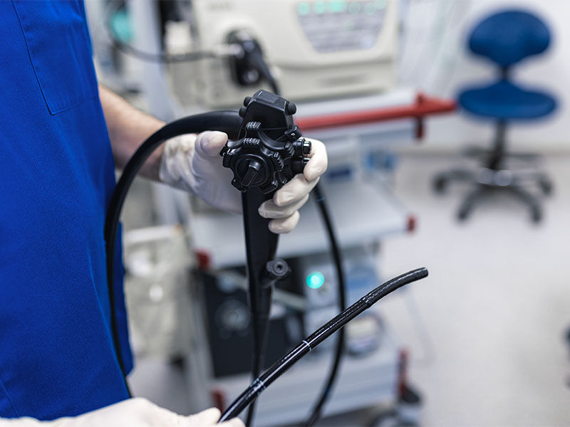 Kolonoskopi nedir ve neden yaptırılması gerekir? Kolonoskopi nedir ve neden yaptırılması gerekir? - 1. Resim