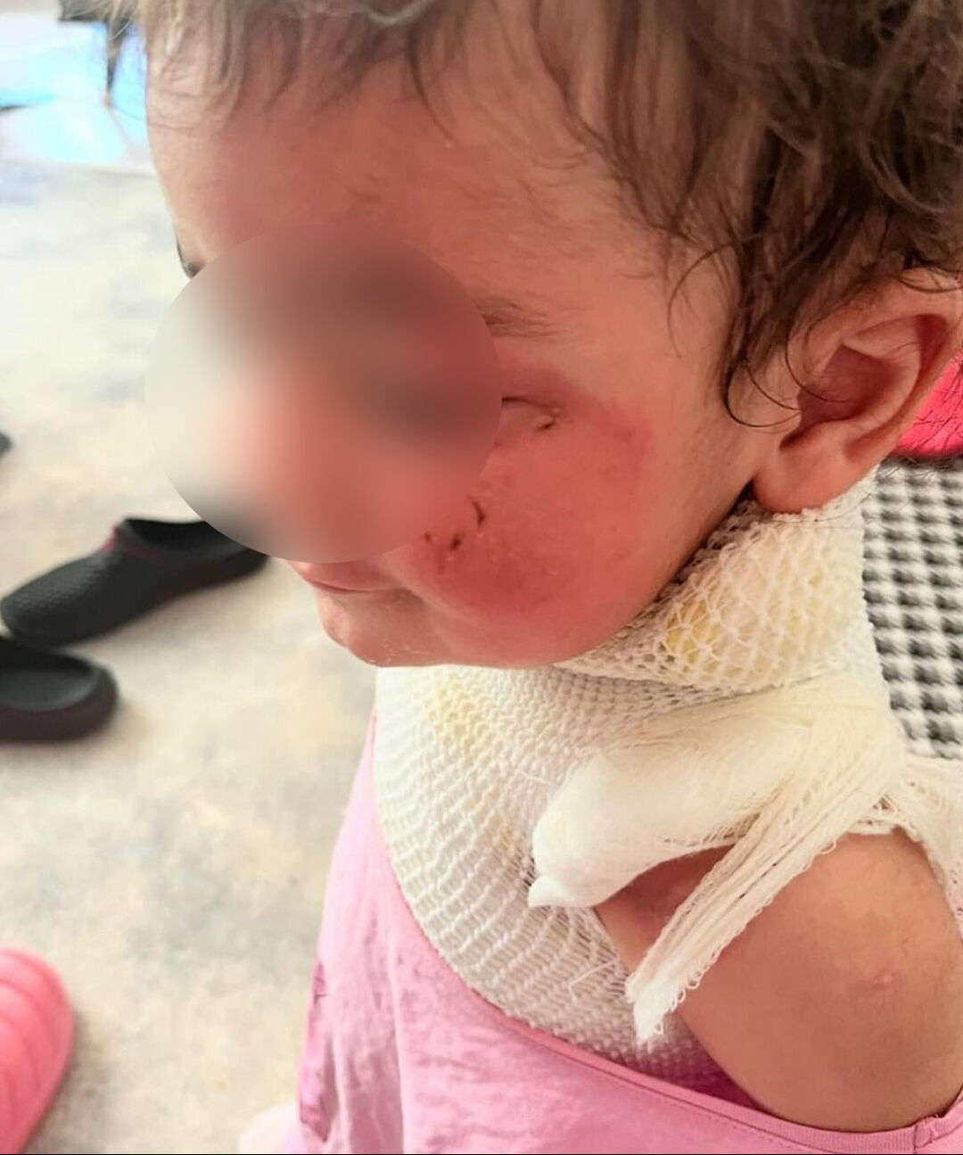 Kreşte skandal! 1.5 yaşındaki bebeği kahveyle yaktılar - 3. Resim