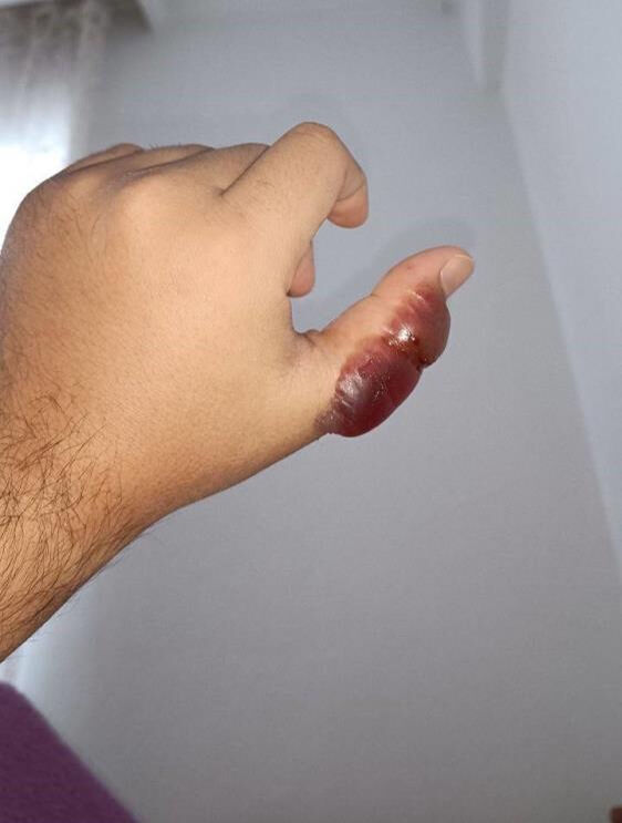 Ölü sanıp yanına yanına yaklaştı, elini sokunca anladı! Aslan balığı hastanelik etti - 5. Resim