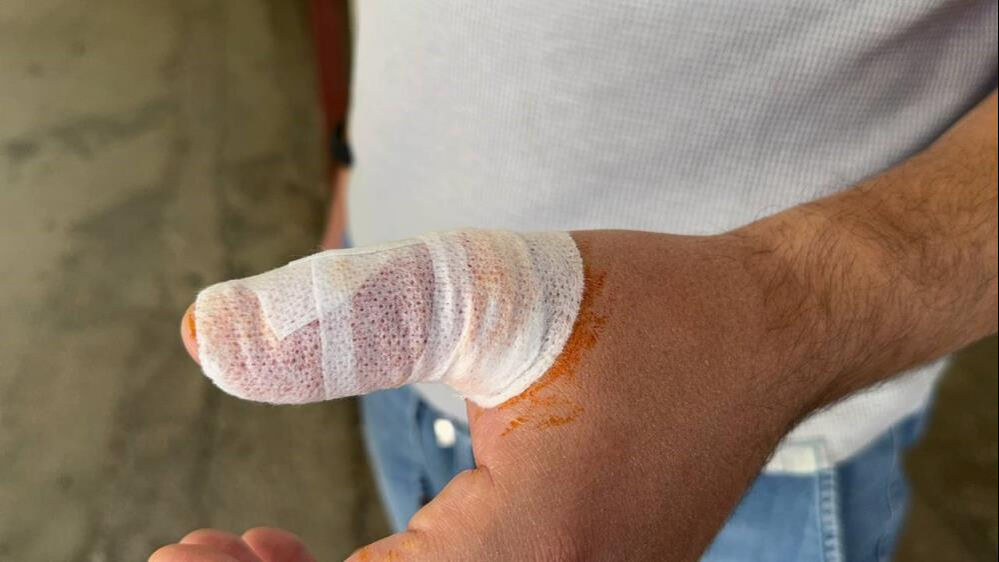 Ölü sanıp yanına yanına yaklaştı, elini sokunca anladı! Aslan balığı hastanelik etti - 4. Resim