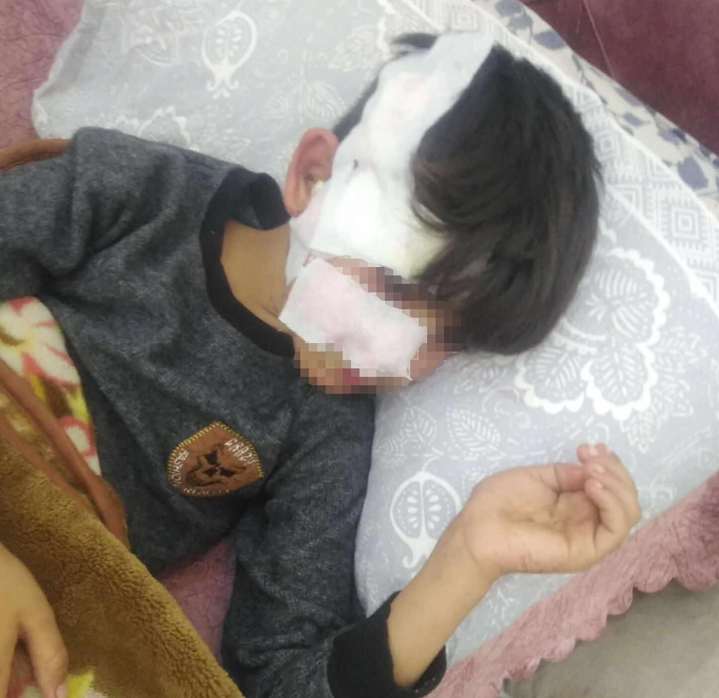 Gaziantep'te 8 yaşındaki çocuğa 5 sokak köpeği saldırdı - 1. Resim