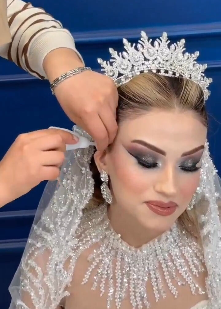 Geline kepçe kulak operasyonu! Düğün günündeki çözüm ağızları açık bıraktı Geline kepçe kulak operasyonu! Düğün günündeki çözüm ağızları açık bıraktı - 1. Resim