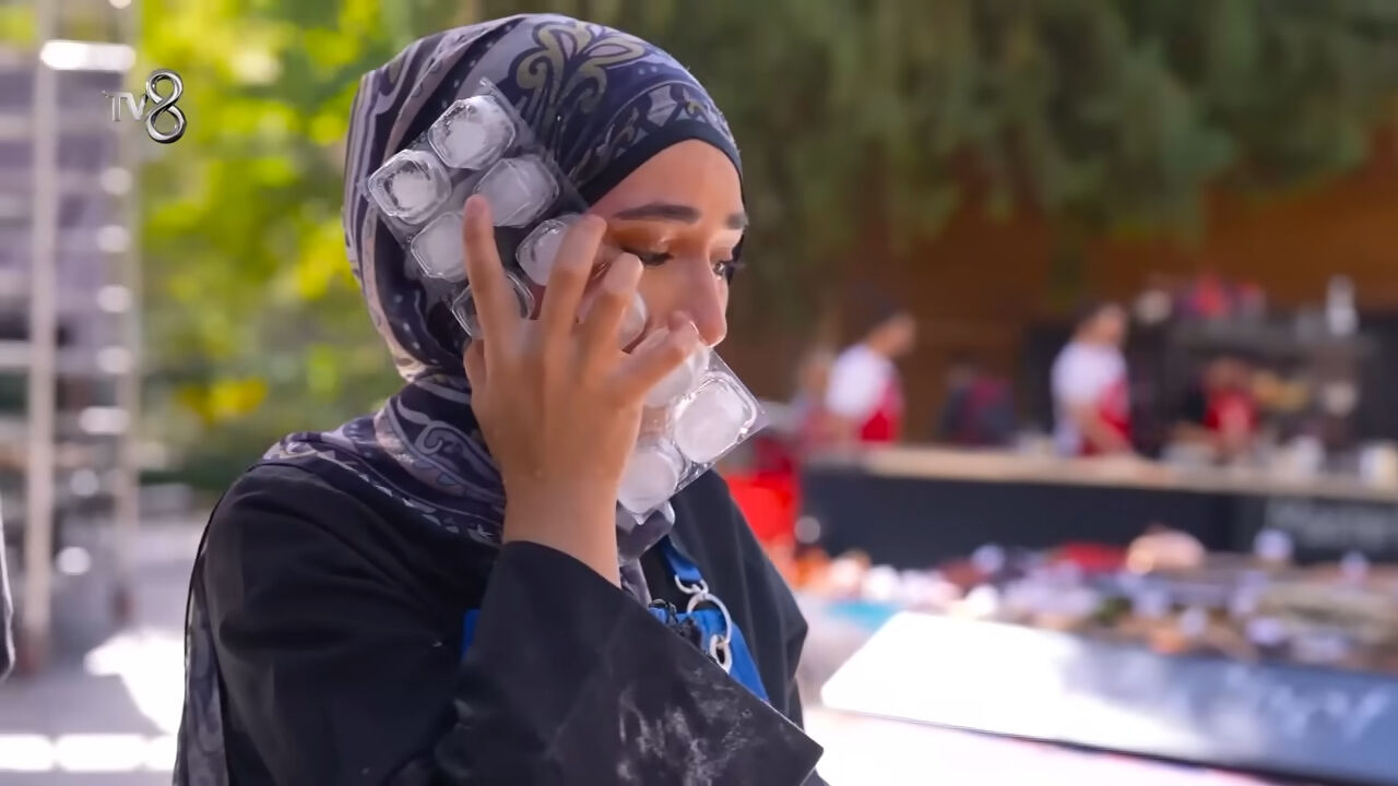 Yüzü yanan MasterChef Beyza’nın sağlık durumu! Şef Somer Sivrioğlu açıkladı - 5. Resim