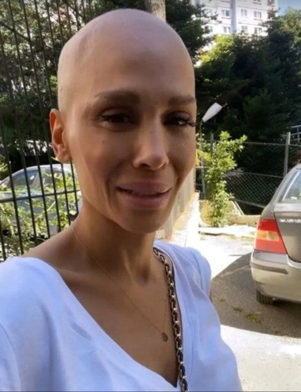 Kanserle mücadele ediyordu! Şimal'e gelen o yorumlar şaşırttı! İfşa edip isyan etti - 2. Resim