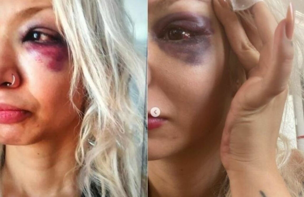 Sevgilisi Aybike Çelik’i darp eden Yüzyüzeyken Konuşuruz'un gitaristi Can Tunaboylu'nun cezası belli oldu Sevgilisi Aybike Çelik’i darp eden Yüzyüzeyken Konuşuruz'un gitaristi Can Tunaboylu'nun cezası belli oldu - 3. Resim