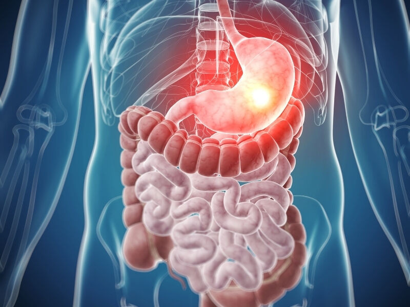 Gıda zehirlenmesi hakkında dikkat edilmesi gereken noktalar - 2. Resim