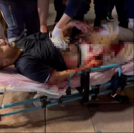 Yolda yürüyen bir kişinin küfrünü üzerine alındı! Defalarca bıçakladı - 5. Resim