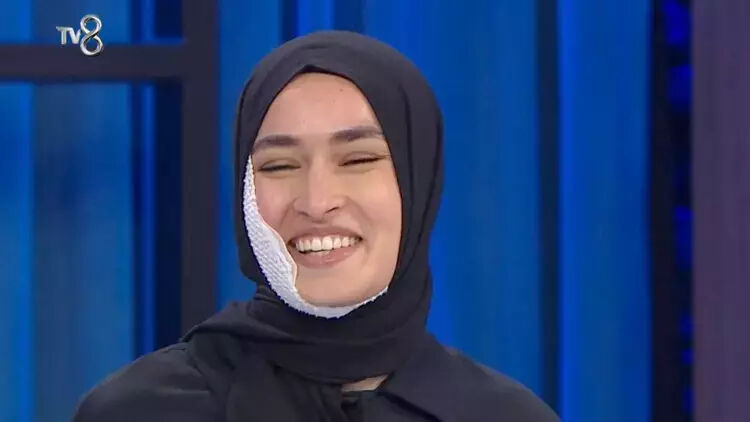 MasterChef Beyza yarışmaya devam edecek mi, son durumu ne? Yüzüne kızgın yağ dökülmüştü  - 2. Resim